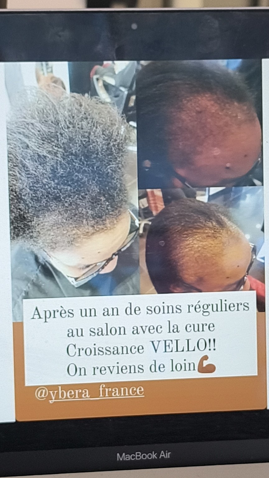 Exemple d’évolution capillaire présenté lors de la formation Ybera Vello